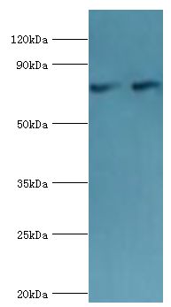 CTCF Antibody - Western blot. All lanes: Transcriptional repressor CTCF antibody at 6 ug/ml. Lane 1: PC-3 whole cell lysate. Lane 1: MCF-7 whole cell lysate. Secondary antibody: Goat polyclonal to rabbit at 1:10000 dilution. Predicted band size: 83 kDa. Observed band size: 83 kDa Immunohistochemistry.