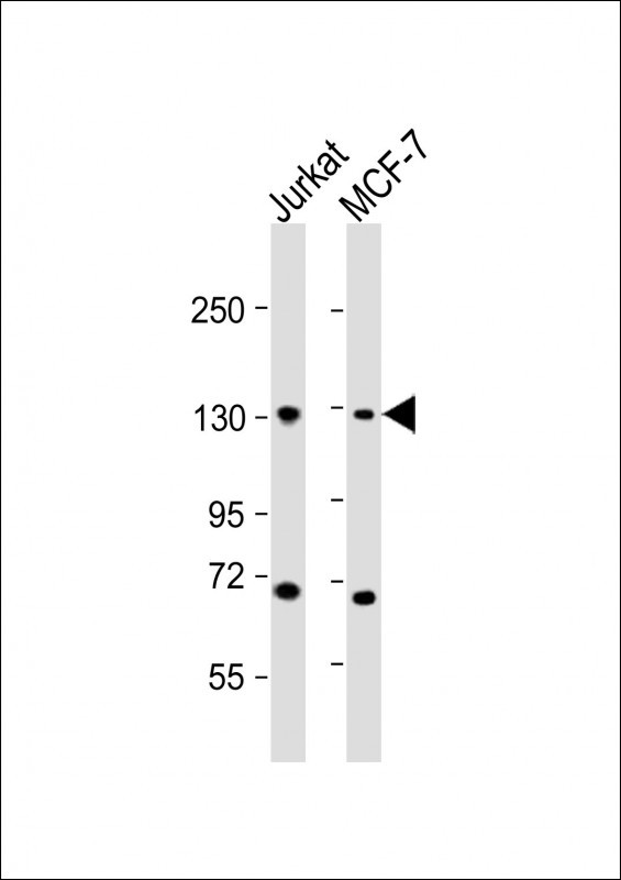 CTCF Antibody - All lanes: Anti-CTCF Antibody (Center) at 1:2000 dilution. Lane 1: Jurkat whole cell lysates. Lane 2: MCF-7 whole cell lysates Lysates/proteins at 20 ug per lane. Secondary Goat Anti-Rabbit IgG, (H+L), Peroxidase conjugated at 1:10000 dilution. Predicted band size: 83 kDa. Blocking/Dilution buffer: 5% NFDM/TBST.