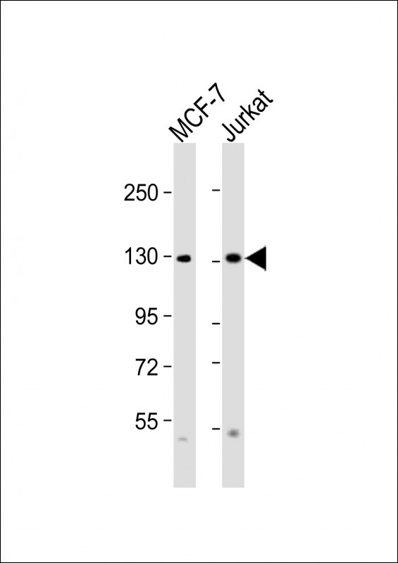 CTCF Antibody - All lanes: Anti-CTCF Antibody (Center) at 1:2000 dilution. Lane 1: MCF-7 whole cell lysates. Lane 2: Jurkat whole cell lysates Lysates/proteins at 20 ug per lane. Secondary Goat Anti-Rabbit IgG, (H+L), Peroxidase conjugated at 1:10000 dilution Predicted band size: 83 kDa. Blocking/Dilution buffer: 5% NFDM/TBST.