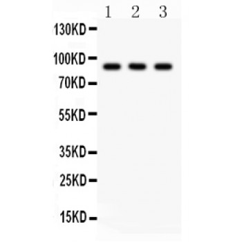 CTCF Antibody - CTCF antibody Western blot. All lanes: Anti CTCF at 0.5 ug/ml. Lane 1: Rat Thymus Tissue Lysate at 50 ug. Lane 2: Rat Gaster Tissue Lysate at 50 ug. Lane 3: Human Placenta Tissue Lysate at 50 ug. Predicted band size: 88 kD. Observed band size: 88 kD.