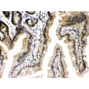 CTCF Antibody - CTCF antibody IHC-paraffin. IHC(P): Mouse Intestine Tissue.