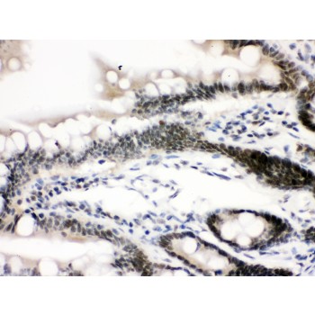 CTCF Antibody - CTCF antibody IHC-paraffin. IHC(P): Rat Intestine Tissue.
