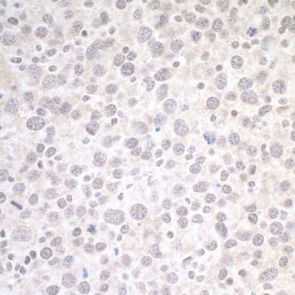 CTCF Antibody - Detection of mouse CTCF by immunohistochemistry. Sample: FFPE section of mouse renal cell carcinoma. Antibody: Affinity purified rabbit anti-CTCF antibody (lot 5) used at 1:2000. Secondary: HRP-conjugated goat anti-rabbit IgG.