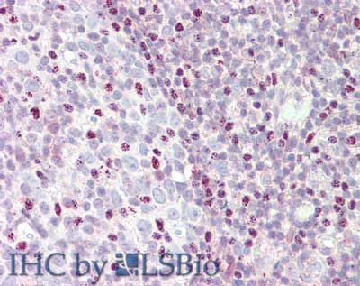 CTCF Antibody - Immunohistochemistry of rabbit anti-CTCF antibody. Tissue: tonsil. Fixation: formalin fixed paraffin embedded. Antigen retrieval: not required. Primary antibody: Anti-CTCF at 5 µg/mL for 1 h at RT. Secondary antibody: Peroxidase rabbit secondary antibody at 1:10,000 for 45 min at RT. Staining: CTCF as precipitated red signal with hematoxylin purple nuclear counterstain.