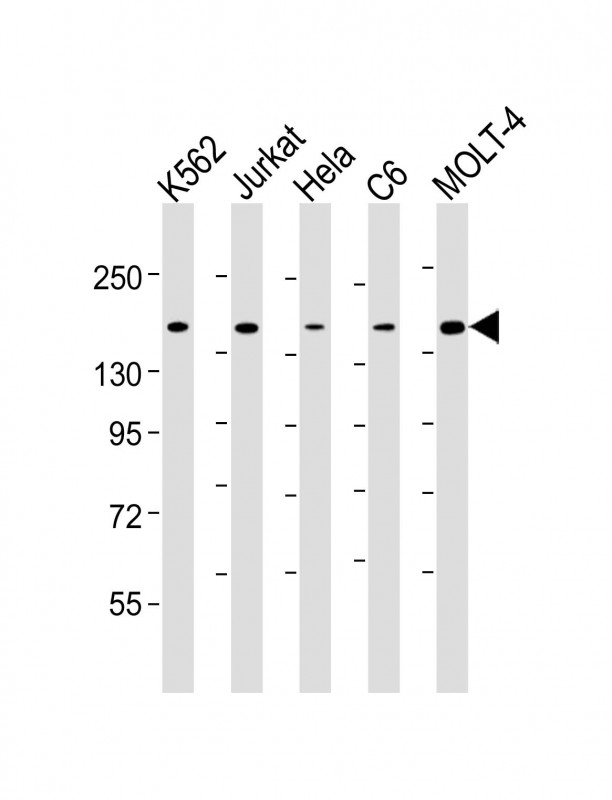 CTCF Antibody - All lanes: Anti-CTCF Antibody at 1:4000 dilution Lane 1: K562 whole cell lysate Lane 2: Jurkat whole cell lysate Lane 3: Hela whole cell lysate Lane 4: C6 whole cell lysate Lane 5: MOLT-4 whole cell lysate Lysates/proteins at 20 µg per lane. Secondary Goat Anti-mouse IgG, (H+L), Peroxidase conjugated at 1/10000 dilution. Predicted band size: 83 kDa Blocking/Dilution buffer: 5% NFDM/TBST.