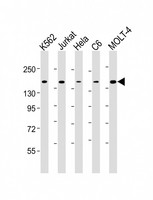 CTCF Antibody - All lanes: Anti-CTCF Antibody at 1:4000 dilution Lane 1: K562 whole cell lysate Lane 2: Jurkat whole cell lysate Lane 3: Hela whole cell lysate Lane 4: C6 whole cell lysate Lane 5: MOLT-4 whole cell lysate Lysates/proteins at 20 µg per lane. Secondary Goat Anti-mouse IgG, (H+L), Peroxidase conjugated at 1/10000 dilution. Predicted band size: 83 kDa Blocking/Dilution buffer: 5% NFDM/TBST.
