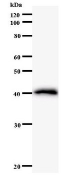 CTCF Antibody - Western blot of immunized recombinant protein using CTCF antibody.