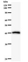 CTCF Antibody - Western blot of immunized recombinant protein using CTCF antibody.