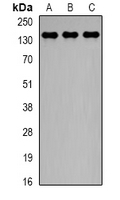 CTCF Antibody - Western blot analysis of CTCF expression in HeLa (A); PC3 (B); COS7 (C) whole cell lysates.