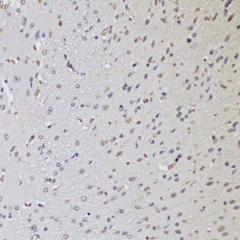 CTCF Antibody - Immunohistochemistry of paraffin-embedded rat brain using CTCF antibody at dilution of 1:100 (20x lens).
