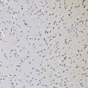 CTCF Antibody - Immunohistochemistry of paraffin-embedded rat brain using CTCF antibody at dilution of 1:100 (20x lens).