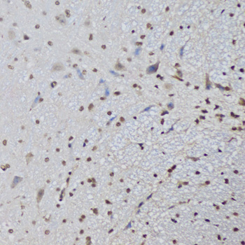 CTCF Antibody - Immunohistochemistry of paraffin-embedded mouse brain using CTCF antibody at dilution of 1:100 (20x lens).