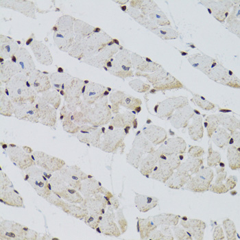 CTCF Antibody - Immunohistochemistry of paraffin-embedded mouse heart using CTCF antibody at dilution of 1:100 (40x lens).