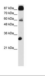 CTCF Antibody - Transfected 293T Cell Lysate.  This image was taken for the unconjugated form of this product. Other forms have not been tested.