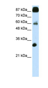 CTCF Antibody - CTCF antibody Western blot of Transfected 293T cell lysate. This image was taken for the unconjugated form of this product. Other forms have not been tested.