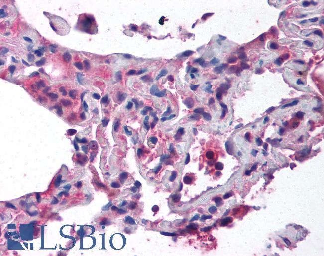 CTCF Antibody - Anti-CTCF antibody IHC of human lung. Immunohistochemistry of formalin-fixed, paraffin-embedded tissue after heat-induced antigen retrieval. Antibody concentration 5 ug/ml.  This image was taken for the unconjugated form of this product. Other forms have not been tested.