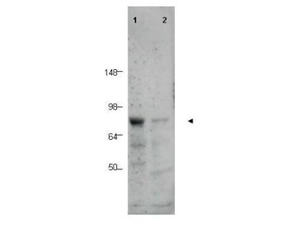 CTCFL / BORIS Antibody - Anti-BORIS Antibody - Western Blot. Western blot of Affinity Purified anti-BORIS antibody shows detection of a predominant band corresponding to BORIS in human tissue lysates (arrowhead). Lane 1 contains lysate from human prostate tissue. Lane 2 contains lysate from human spleen tissue. A predominant band at ~75 kD is observed. Molecular weight estimation was made by comparison to prestained MW markers as indicated.