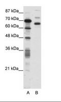 CTCFL / BORIS Antibody - A: Marker, B: Jurkat Cell Lysate.  This image was taken for the unconjugated form of this product. Other forms have not been tested.