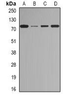 CTCFL / BORIS Antibody - Western blot analysis of BORIS expression in Jurkat (A); HeLa (B); mouse heart (C); rat testis (D) whole cell lysates.
