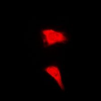 CTCFL / BORIS Antibody - Immunofluorescent analysis of BORIS staining in MCF7 cells. Formalin-fixed cells were permeabilized with 0.1% Triton X-100 in TBS for 5-10 minutes and blocked with 3% BSA-PBS for 30 minutes at room temperature. Cells were probed with the primary antibody in 3% BSA-PBS and incubated overnight at 4 deg C in a humidified chamber. Cells were washed with PBST and incubated with a DyLight 594-conjugated secondary antibody (red) in PBS at room temperature in the dark.
