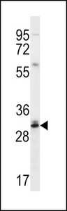 CTDNEP1 / DULLARD Antibody - DULLARD Antibody western blot of Jurkat cell line lysates (35 ug/lane). The DULLARD antibody detected the DULLARD protein (arrow).