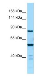 CTDP1 / FCP1 Antibody - CTDP1 / FCP1 antibody Western Blot of Fetal kidney.  This image was taken for the unconjugated form of this product. Other forms have not been tested.