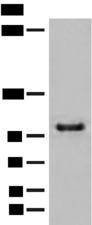 CTDP1 / FCP1 Antibody - Western blot analysis of HEPG2 cell lysate  using CTDP1 Polyclonal Antibody at dilution of 1:500