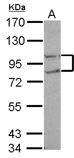 CTDP1 / FCP1 Antibody - Sample (30 ug of whole cell lysate) A: A549 7.5% SDS PAGE CTDP1 / FCP1 antibody diluted at 1:1000