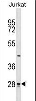 CTDSP1 / SCP1 Antibody - CTDSP1 Antibody western blot of Jurkat cell line lysates (35 ug/lane). The CTDSP1 antibody detected the CTDSP1 protein (arrow).