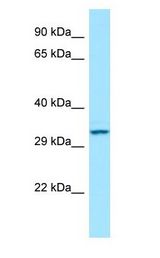 CTDSP1 / SCP1 Antibody - CTDSP1 / SCP1 antibody Western Blot of Jurkat.  This image was taken for the unconjugated form of this product. Other forms have not been tested.