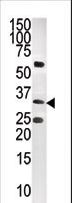 CTDSP1 / SCP1 Antibody - The anti-CTDSP1-V250 is used in Western blot to detect CTDSP1-V250 in CEM tissue lysate.
