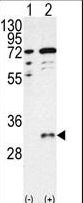 CTDSP1 / SCP1 Antibody - Western blot of CTDSP1 (arrow) using CTDSP1-V250 Antibody. 293 cell lysates (2 ug/lane) either nontransfected (Lane 1) or transiently transfected with the CTDSP1 gene (Lane 2) (Origene Technologies).