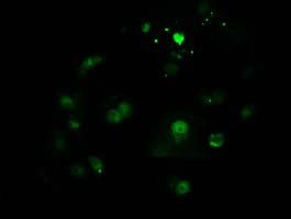 CTDSP1 / SCP1 Antibody - Anti-CTDSP1 mouse monoclonal antibody immunofluorescent staining of COS7 cells transiently transfected by pCMV6-ENTRY CTDSP1.