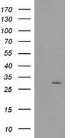 CTDSP1 / SCP1 Antibody - HEK293T cells were transfected with the pCMV6-ENTRY control (Left lane) or pCMV6-ENTRY CTDSP1 (Right lane) cDNA for 48 hrs and lysed. Equivalent amounts of cell lysates (5 ug per lane) were separated by SDS-PAGE and immunoblotted with anti-CTDSP1.