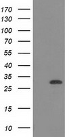 CTDSP1 / SCP1 Antibody - HEK293T cells were transfected with the pCMV6-ENTRY control (Left lane) or pCMV6-ENTRY CTDSP1 (Right lane) cDNA for 48 hrs and lysed. Equivalent amounts of cell lysates (5 ug per lane) were separated by SDS-PAGE and immunoblotted with anti-CTDSP1.