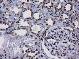 CTDSP1 / SCP1 Antibody - IHC of paraffin-embedded Human Kidney tissue using anti-CTDSP1 mouse monoclonal antibody.