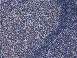 CTDSP1 / SCP1 Antibody - IHC of paraffin-embedded Human lymph node tissue using anti-CTDSP1 mouse monoclonal antibody.