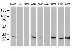 CTDSP1 / SCP1 Antibody - Western blot of extracts (35ug) from 9 different cell lines by using anti-CTDSP1 monoclonal antibody.