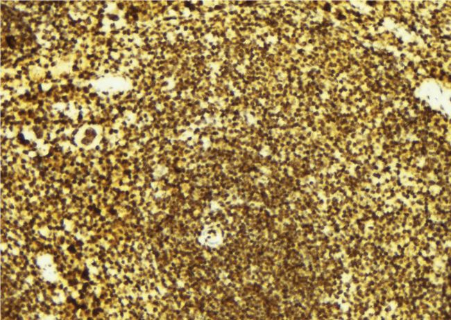 CTDSP1 / SCP1 Antibody - 1:100 staining mouse spleen tissue by IHC-P. The sample was formaldehyde fixed and a heat mediated antigen retrieval step in citrate buffer was performed. The sample was then blocked and incubated with the antibody for 1.5 hours at 22°C. An HRP conjugated goat anti-rabbit antibody was used as the secondary.