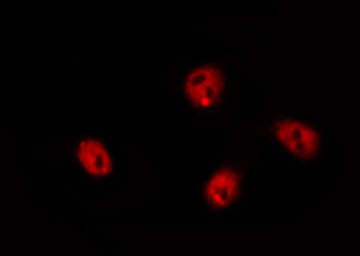 CTDSP1 / SCP1 Antibody - Staining HeLa cells by IF/ICC. The samples were fixed with PFA and permeabilized in 0.1% Triton X-100, then blocked in 10% serum for 45 min at 25°C. The primary antibody was diluted at 1:200 and incubated with the sample for 1 hour at 37°C. An Alexa Fluor 594 conjugated goat anti-rabbit IgG (H+L) Ab, diluted at 1/600, was used as the secondary antibody.