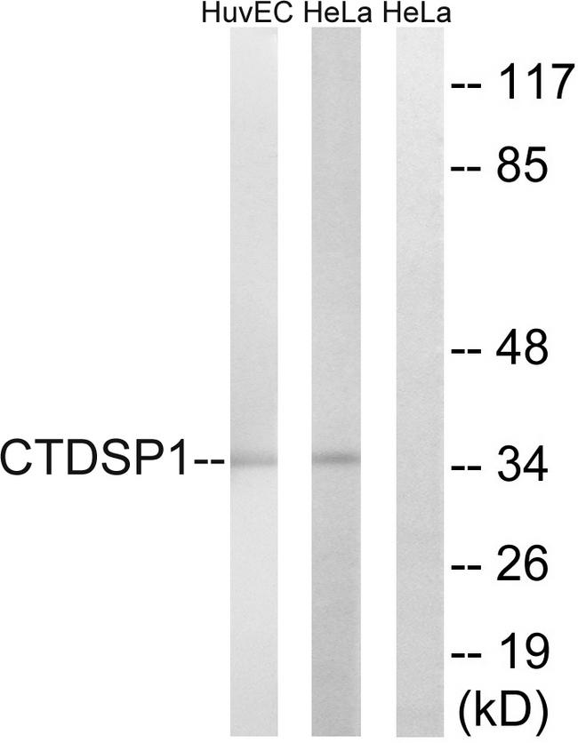 CTDSP1 / SCP1 Antibody - Western blot analysis of extracts from HUVEC cells and HeLa cells, using CTDSP1 antibody.