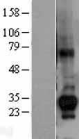 CTDSP1 / SCP1 Protein - Western validation with an anti-DDK antibody * L: Control HEK293 lysate R: Over-expression lysate