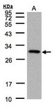 CTDSP2 Antibody - Sample (30 ug of whole cell lysate). A:293T. 12% SDS PAGE. CTDSP2 antibody. CTDSP2 antibody diluted at 1:1000.