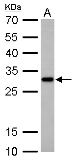 CTDSP2 Antibody - CTDSP2 antibody detects CTDSP2 protein by Western blot analysis. A. 30 ug PC-12 whole cell lysate/extract. 12 % SDS-PAGE. CTDSP2 antibody dilution:1:1000