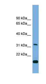 CTDSP2 Antibody - CTDSP2 antibody western blot of RPMI-8226 cell lysate.  This image was taken for the unconjugated form of this product. Other forms have not been tested.
