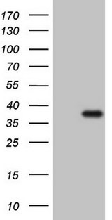 CTDSP2 Antibody - HEK293T cells were transfected with the pCMV6-ENTRY control. (Left lane) or pCMV6-ENTRY CTDSP2. (Right lane) cDNA for 48 hrs and lysed. Equivalent amounts of cell lysates. (5 ug per lane) were separated by SDS-PAGE and immunoblotted with anti-CTDSP2. (1:2000)