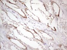 CTDSP2 Antibody - Immunohistochemical staining of paraffin-embedded Human Kidney tissue within the normal limits using anti-CTDSP2 mouse monoclonal antibody. (Heat-induced epitope retrieval by 1mM EDTA in 10mM Tris buffer. (pH8.5) at 120°C for 3 min. (1:150)