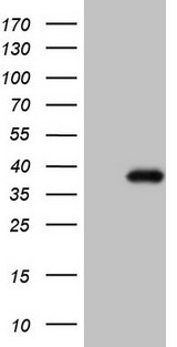 CTDSP2 Antibody - HEK293T cells were transfected with the pCMV6-ENTRY control. (Left lane) or pCMV6-ENTRY CTDSP2. (Right lane) cDNA for 48 hrs and lysed. Equivalent amounts of cell lysates. (5 ug per lane) were separated by SDS-PAGE and immunoblotted with anti-CTDSP2. (1:2000)