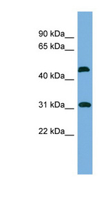 CTDSP2 Antibody - CTDSP2 antibody Western blot of Fetal Kidney lysate. This image was taken for the unconjugated form of this product. Other forms have not been tested.