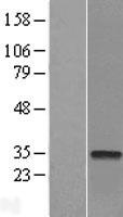 CTDSP2 Protein - Western validation with an anti-DDK antibody * L: Control HEK293 lysate R: Over-expression lysate